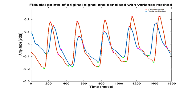 Denoising wrist pulse signals using variance thresholding technique
