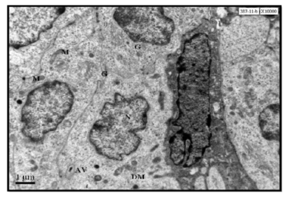 Electron micrograph studies on the effects of fluoxetine in depression-induced adult female rat ovaries