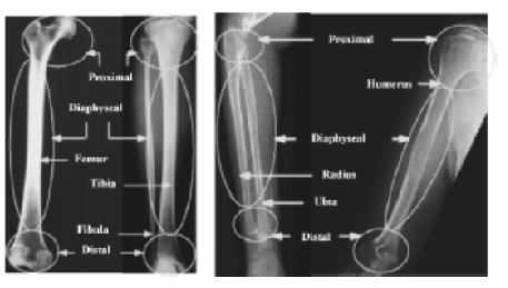 Classification of Long-Bone Fractures Using Modified Faster RCNN for X-Ray Images