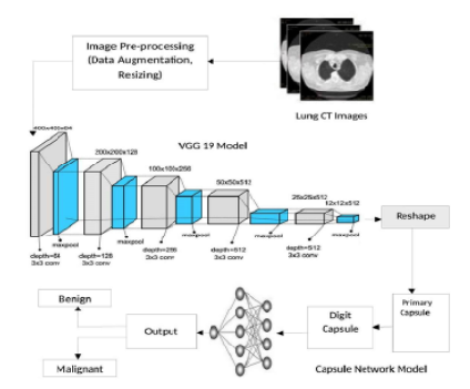 A Hybrid VGG 19 and Capsule Network Based Deep Learning Model for Lung ...