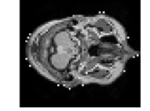 Enhancing Diagnostic Accuracy of Brain MRI Using Super-Resolution ...