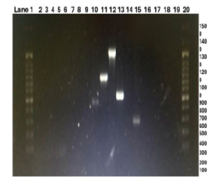 Single-Gene Target PCR Assays for Identification of Salmonella typhi