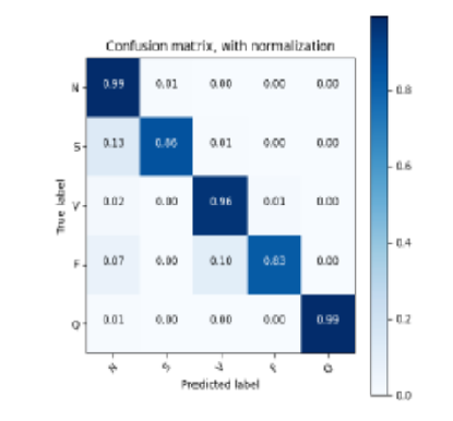 Advanced Arrhythmia Classification Using Transformer-Based CNN