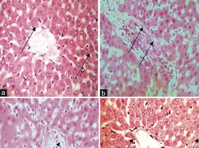 Coenzyme Q 10 Abrogates Flutamide-induced Hepatotoxicity in Albino Rats