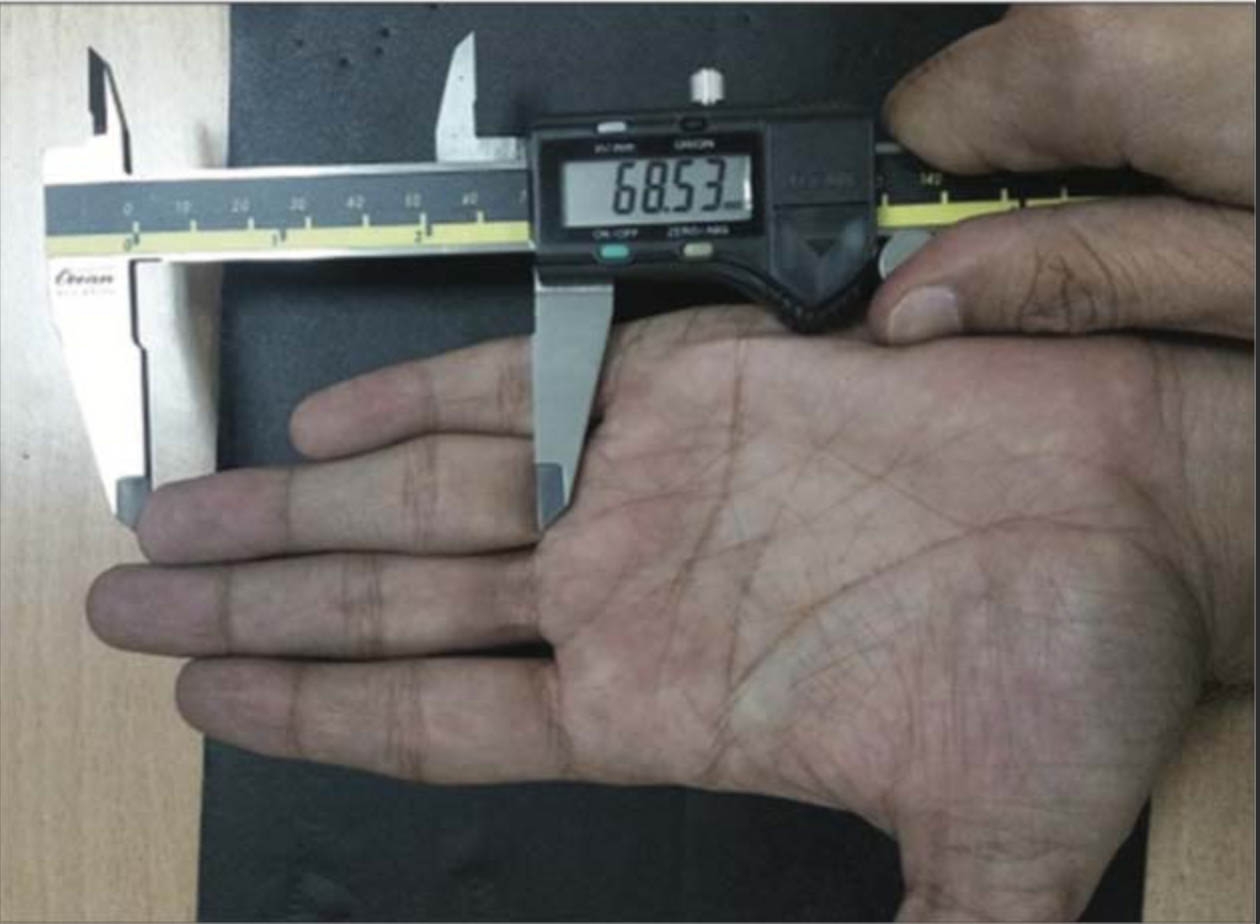 Estimation of Stature from Ring Finger Length in Haryanavi Population: An Anthropometric Study