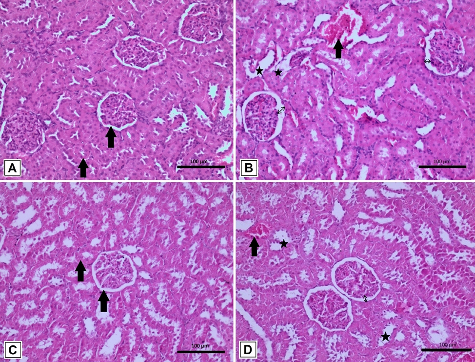 Protective Effects of Alpha Lipoic Acid on Ischemia-Reperfusion Induced Kidney Damage