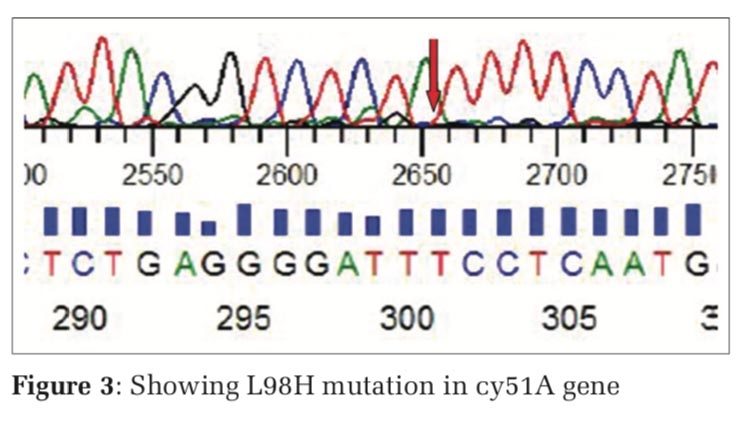 Detection of Azole Drug Resistance of the Aspergillus Species Cyp51a Gene by PCR