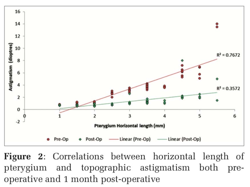 Evaluation of Corneal Topographic Changes Following Pterygium Surgery and Correlation with Size of Pterygium