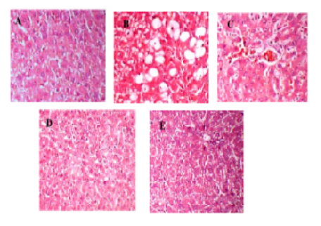 Evaluation of Hepatoprotective and Anti-Inflammatory Activities of Aqueous Leaf Extract of Blumea mollis in Rats