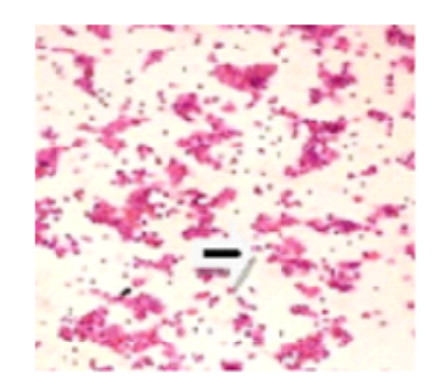 Assessing the Beneficial Effects of Ellagic Acid in Mitigating Lead Induced Toxicity in Haematopoietic System